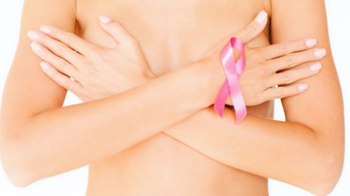 Breast reconstruction after a mastectomy