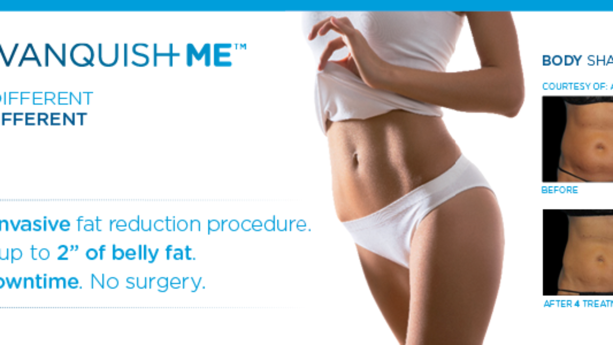 Non-Surgical Fat Removal Review - Vanquish Liposuction Results