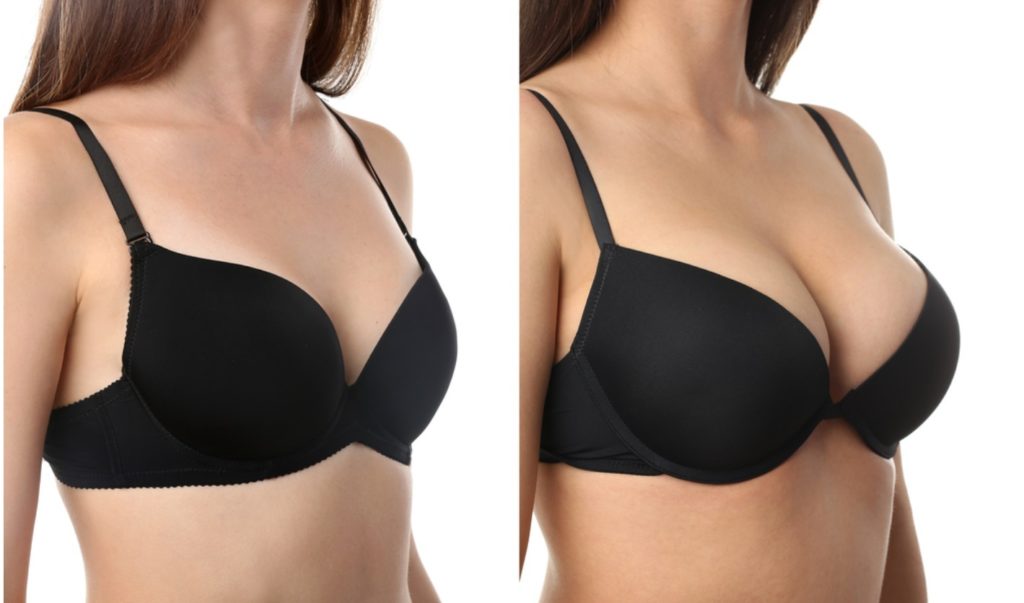 Everything You Need to Know About Breast Surgery