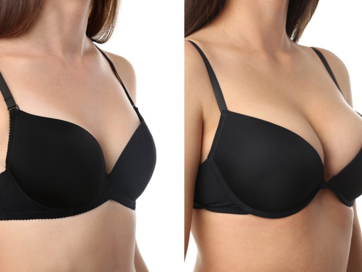 Breast Surgery and Post-Surgery Bras: Everything You Need to Know